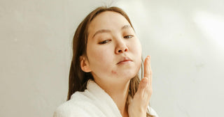 Holiday Skincare Routine: How To Avoid Breakouts During the Festive Season