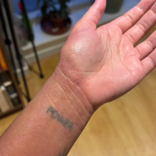 Eczema on hand after Dead Sea Dream products